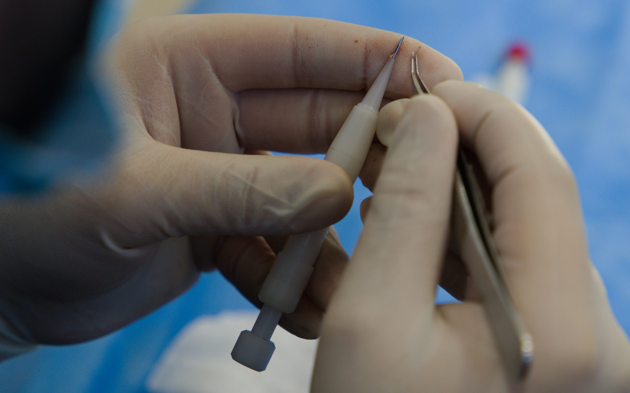 DHI Haartransplantatie